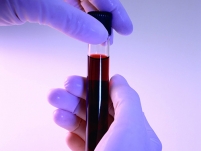 Клиническое значение анализа крови (фрагмент лекции проф. Е.Б.Владимирской)